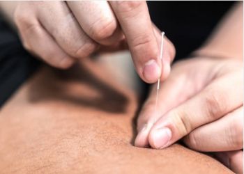 Acupunctuur bij Centrum Vitaal